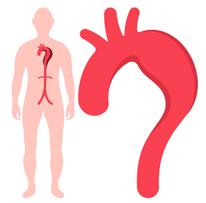 Read more about the article Thoracic Vascular Stent Grafts Market: Key Challenges and Opportunities in the Evolving Medical Devices Sector